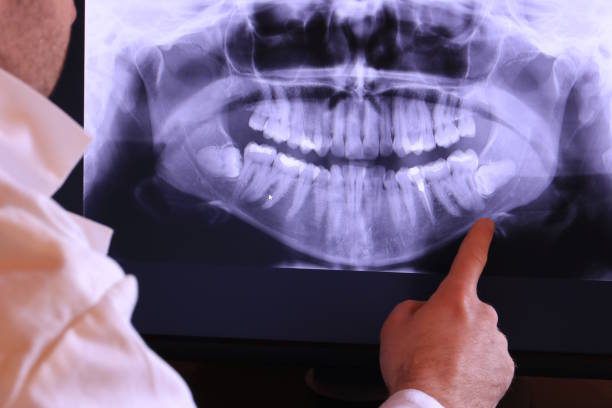 Best Broken Tooth Emergency  in Orlinda, TN