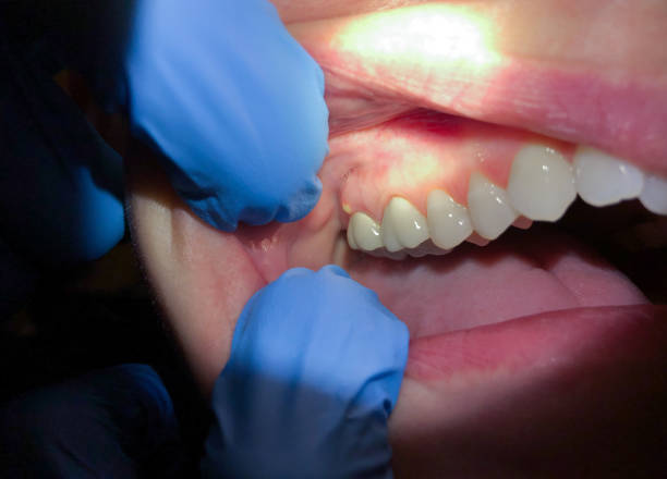 Best Dentist Open Late Near Me  in Orlinda, TN