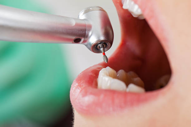 Best Knocked-Out Tooth Emergency  in Orlinda, TN